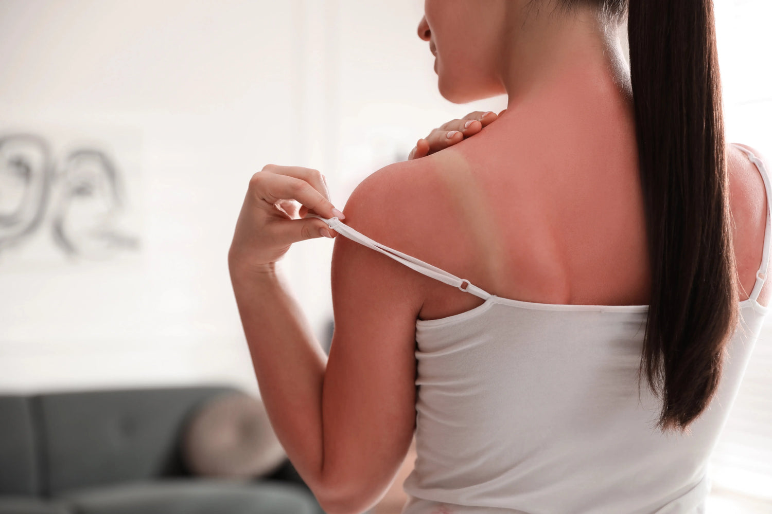 Woman with a sunburned back adjusting her strap