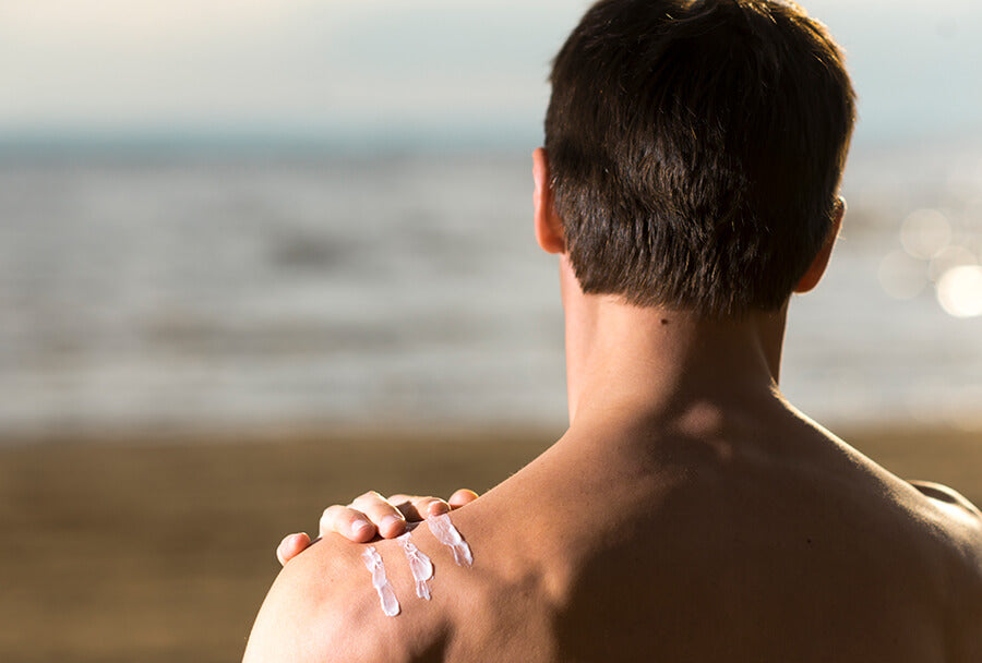 Sunburn and sun protection - treatments and prevention including sunscreen