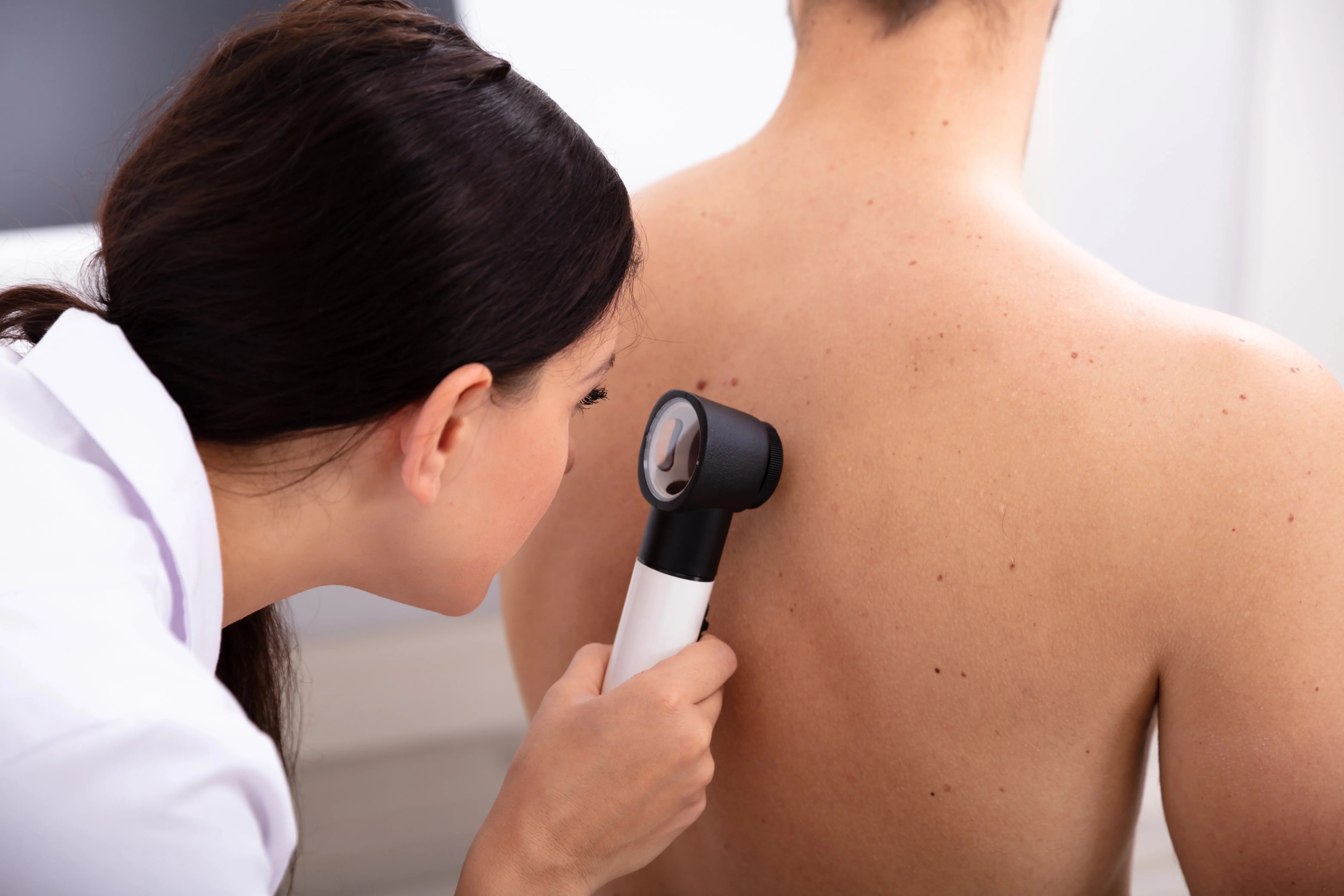 A doctor inspecting patient's back with a dermatoscope