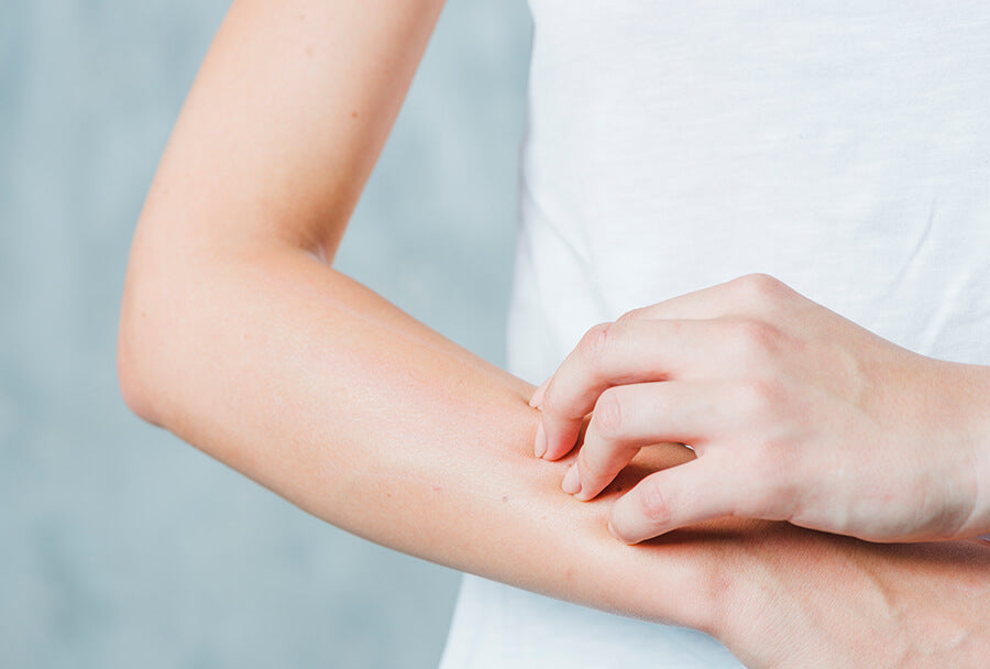 Could You Have Skin Allergies?